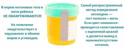 Иногда ацетонурия проходит только после полового созревания