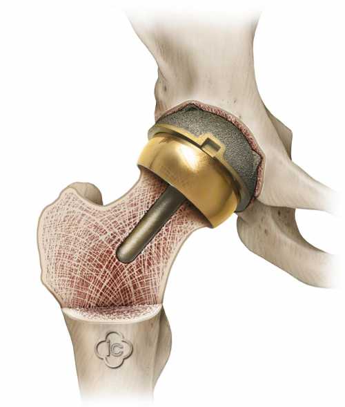 Операция шла часа