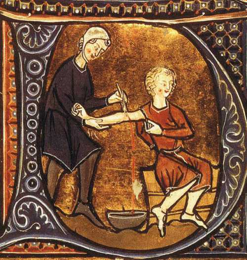 В день, на который назначена гирудо терапия, не стоит пользоваться парфюмиро ванными средствами, в том числе мылом или гелем для душа